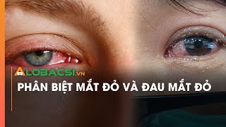 Phân biệt mắt đỏ và đau mắt đỏ