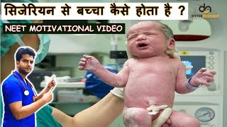 How does a C-section or Cesarean Delivery Take Place?  | NEET Motivation | Future Doctors