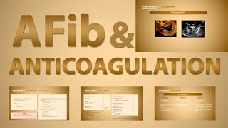 Anticoagulation in Atrial Fibrillation - 3 Situations for Anticoagulation in AF \u0026 its Principles