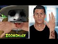 ASMR Animation Help Ronaldo treat bites caused by Zoonomaly