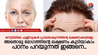 നെറ്റിയിലെ ചുളിവുകള്‍ പ്രായമാകുന്നതിന്റെ ലക്ഷണംമാത്രമല്ല;പഠനം പറയുന്നത് ഇങ്ങനെ..