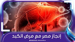 إنجاز مصر مع مرض الكبد .. وعلاج جديد أكثر فاعلية بالمجان
