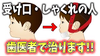 【矯正医が教える】受け口・しゃくれの人は歯医者で治ります！！