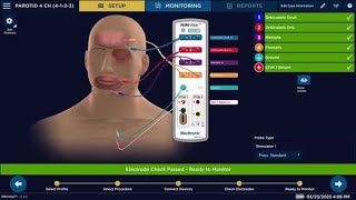 NIM Vital™ nerve monitoring system Set-up - Parotid procedure