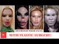 Top 20 Celebrity Plastic Surgery Disasters | Then and now 2024 P2