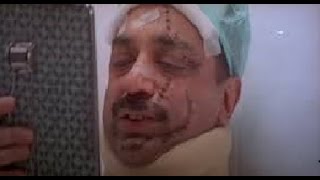 Actor Kamal Hassan Got Injured
