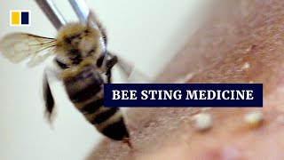 Bee sting as medicine: Syrians turn to apitherapy for alternative treatment