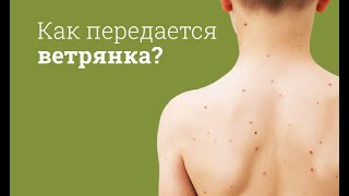 Как передается ветрянка?