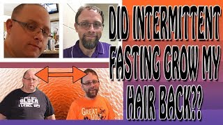 Did intermittent fasting grow my hair back?