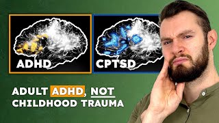 ADHD vs. Trauma: 9 Signs It's Adult ADHD, Not Childhood Trauma (CPTSD)