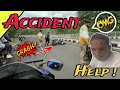 I Had a Bike Accident.And the leg got broken.@Blzevibevlog #myfirstvlog