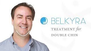 BELKYRA treatment for Double Chin at Preventous Cosmetic Medcine