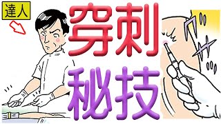 穿刺の秘技とは！？この人は実在します！【６０秒で学べる透析雑学】12話…透析バンザイの弟