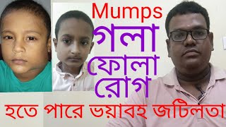 Mumps,গলাফোলা রোগ বা চোয়াল ফোলা রোগ এর লক্ষণ, চিকিৎসা ও ভয়াবহ জটিলতা।Dr.Tarikuzzaman Rubel