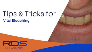 Tips and tricks for vital bleaching of teeth