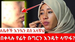 ፊቴ ተበላሸ ብላቹህ ለተጨነቃቹህ ፍቱን መላ ለሴቶች እንኳን ደስ አላቹህ የፊት ቡግሩን በቀላሉ  ለማጥፋት ይከታተሉት ይወዱታል ከMirhan tube ጋር  ||