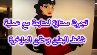 تجربة احدى المتابعات 💐مع عملية الشفط وحقن المؤخرة