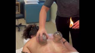 Flash Fire Cupping Technique. Get Massage Training at CITCM Massage School in Calgary.