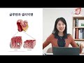 밀가루와 건강 혈당 글루텐 그리고 ati 밀가루 건강하게 먹는 방법 라이프의원 가정의학과 이경실