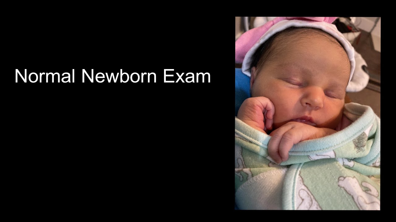 Newborn/Neonatal Physical Exam For Medical Students And Residents - YouTube