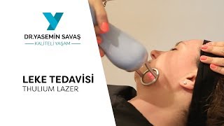 Thulium Lazer ile Leke Tedavisi | Dr. Yasemin Savaş