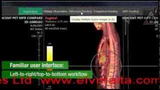 ELV Synapse 3D Fujifilm Medical