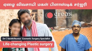 ஏழைகளுக்கும் பிளாஸ்டிக் அறுவை சிகிச்சை.அதனால் நண்மைகள்|| Plastic Surgery || Dr C senthilkumar.