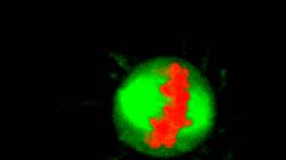Mitosis in 3D - With Chromosome Bridge