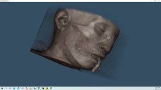 VTK Python Example - MedicalDemo4