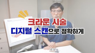 크라운 시술 디지털 스캔으로 정확하게