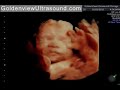 hdlive ultrasound at 28 weeks baby yawns and waves