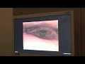 vídeo endoscopia