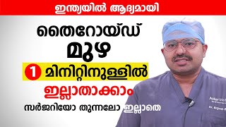 തൈറോയ്ഡ് മുഴ 1 മിനിറ്റിനുള്ളിൽ ഇല്ലാതാക്കാം സർജറിയോ തുന്നലോ ഇല്ലാതെ | Goiter (Enlarged Thyroid)