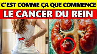 95% Des Personnes Ignorent Ces 7 Signes De Cancer Du Rein - Signes Et Symptômes Du Cancer Du Rein