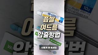 좁쌀 여드름 압출은 이렇게 해보세요🌟 #shorts #여드름