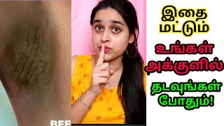 உங்களுக்கு அக்குள் கருப்பா இருக்கா ??கவலை வேண்டாம்!😊WATCH THIS VIDEO