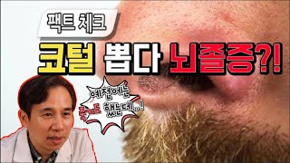 (우리집에 의사가산다 ep.36)안전한 코털 뽑는 방법을 알려드립니다