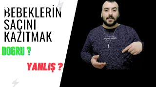 BEBEKLERİN SAÇINI KAZITMAK DOĞRU MU? YANLIŞ MI?