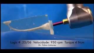 Sistema Rotatorio - Easy Logic - Dr. Fábio Linhares - Endodontia