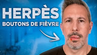 C'EST QUOI UN BOUTON DE FIÈVRE ?