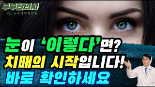 눈이 '이렇다면' 치매의 시작입니다!!! 바로 확인하세요~| 한의학박사, 침구과전문의, 산청김, 김경태원장 ㅣ3863ft 부부한의사