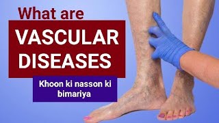 What are  Vascular Diseases | khoon ki nasson ki bimari | Dr.Education