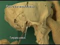 1.7 Step 1. Parts of the adult temporal bone; petrotympanic fissure