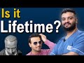 The Life Of Hair Transplant Results! | How Long The Results Will Last? | Dr. Vivek Galani | RQC