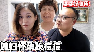 媳婦蘇莎懷孕臉上長痘痘，大吳媽媽心疼讓兒媳婦回國，給她買中藥喝！