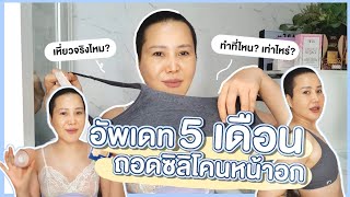 [CC ENG] 5 เดือน หลังถอดซิลิโคนหน้าอก !! เหี่ยวจริงไหม