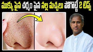 Blackheads | చర్మం పైన ముక్కు పైన నల్ల మచ్చలు పోగొట్టే 2 టిప్స్ | Dr Manthena Satyanarayana Raju