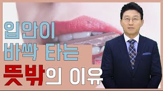 [김현욱의 아침건강] 입안이 바싹타는 뜻밖의 이유