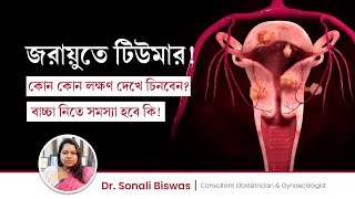 জরায়ুর টিউমারের লক্ষণ ও চিকিৎসা | Uterine fibroids symptoms & treatment