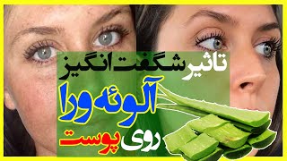 10 خاصیت جادویی الوئه ورا برای مو، پوست و زیبایی